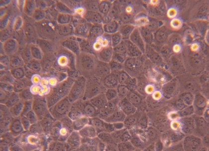 BPH-1人前列腺增生细胞